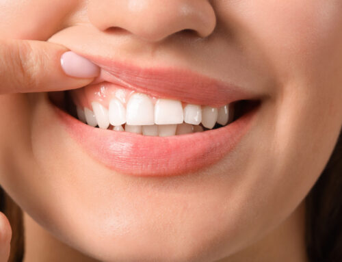 5 Tips to Improve Your Gum Health