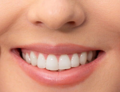 How to Get a Perfect Smile with Cerec Crowns