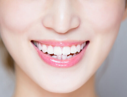 Tooth Bonding: What Is It And Why You Need It