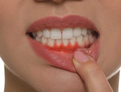 What Happens If You Don’t Get Your Gum Disease Treated?