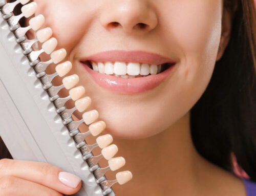 The Science Behind Dental Veneers: Understanding the Procedure and Results