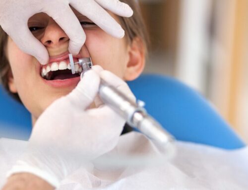 5 Advantages of Routine Dental Cleanings Every Six Months
