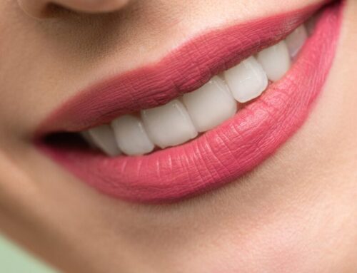 Should You Whiten Your Teeth at Home or See a Dentist? Here’s What to Know