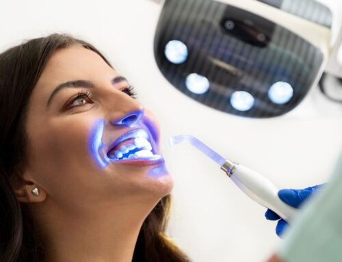 Gum Protection During Whitening: What to Expect at Your Appointment