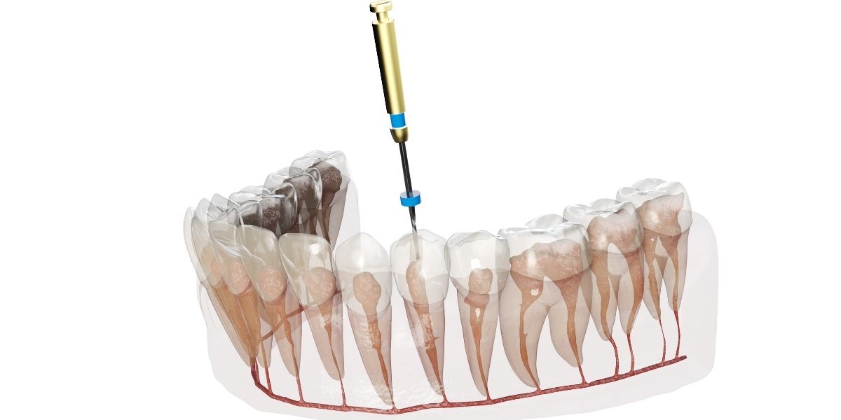 dentist in Herndon, VA