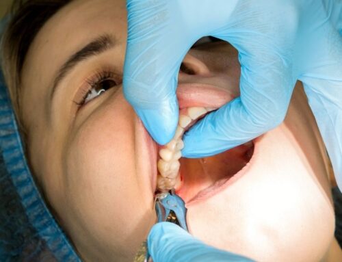 Why Your Dentist Might Recommend a Tooth Extraction