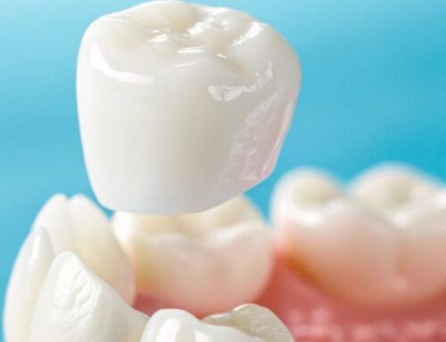 Cracked Tooth? Here’s How a Dental Crown Can Save It