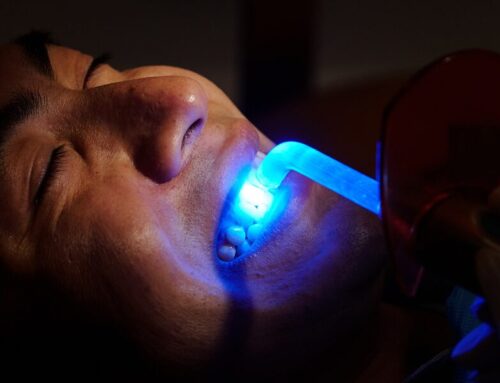 Natural-Looking Composite Fillings for a Healthier Smile in Herndon, VA